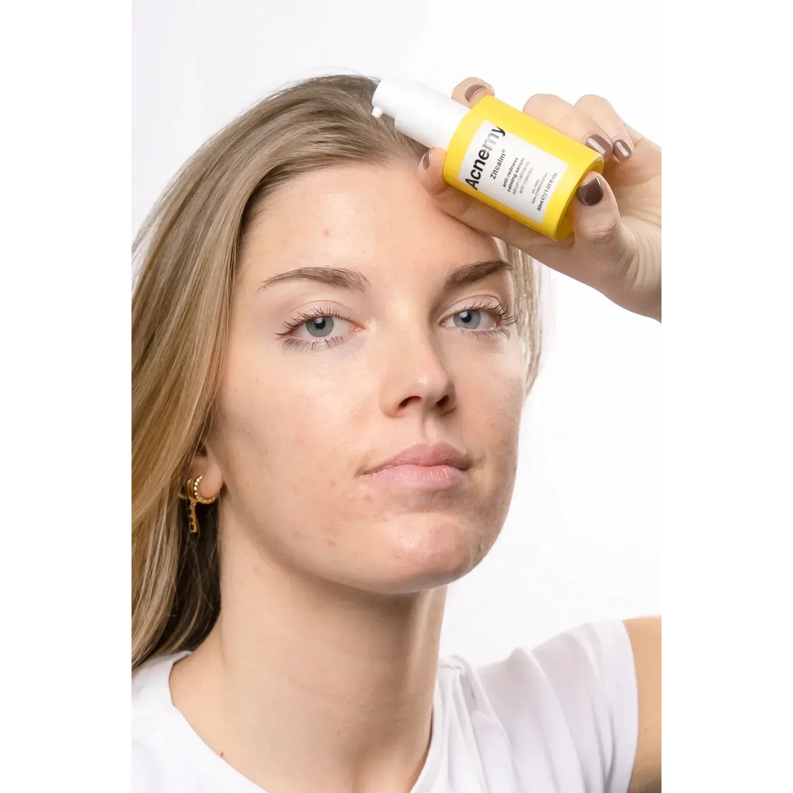 Acnemy Успокаивающая сыворотка против покраснения Zitcalm Serum 30 мл - фото 2
