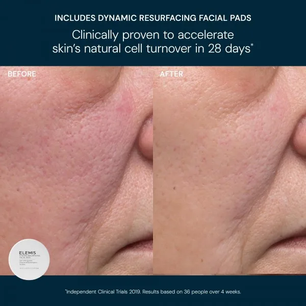 Elemis Тріо для сияния кожи. Kit: Glow Bright Resurfacing Trio - фото 2