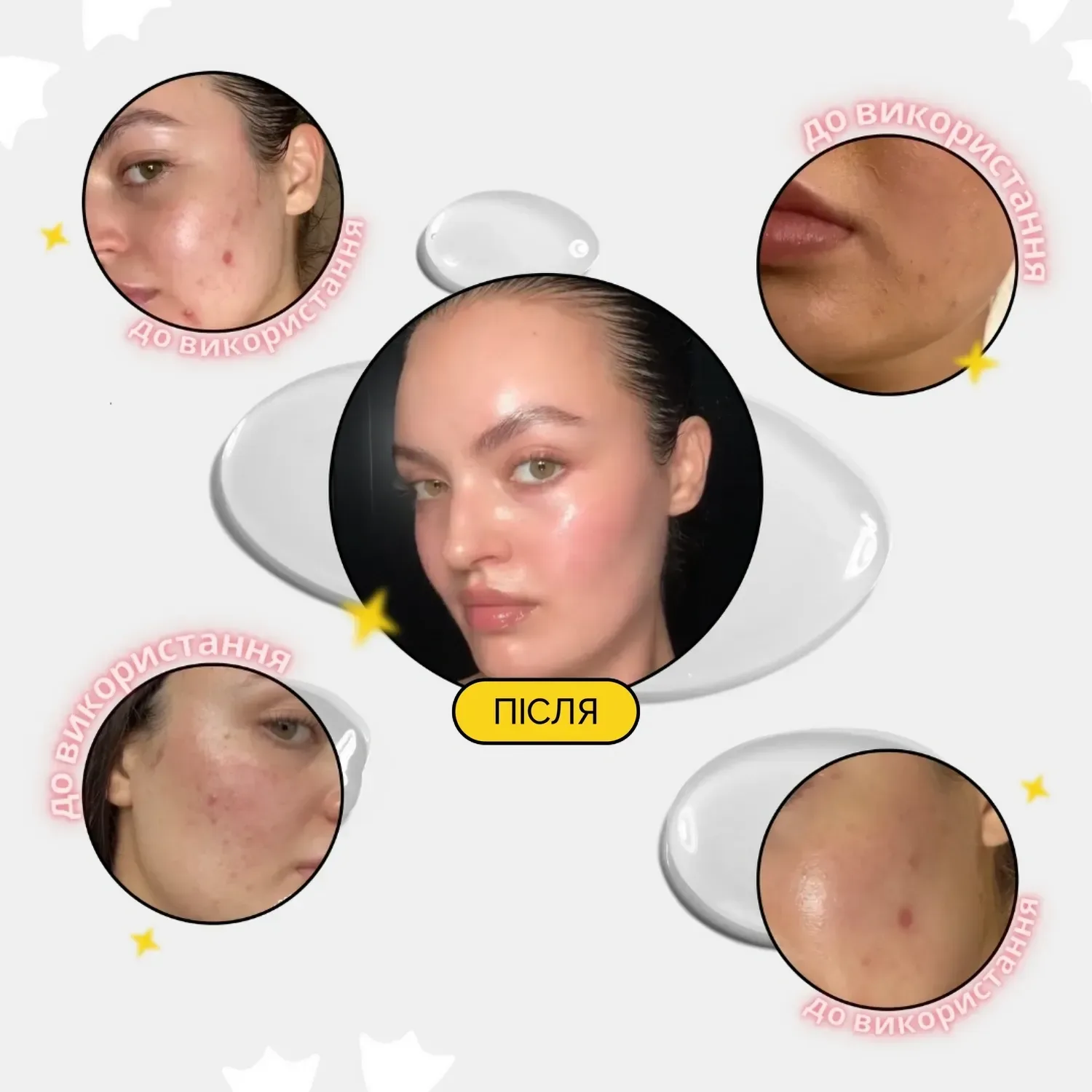 Medicube Устройство для домашнего ухода за кожей 6 в 1 AGE-R Booster Pro Yellow - фото 5