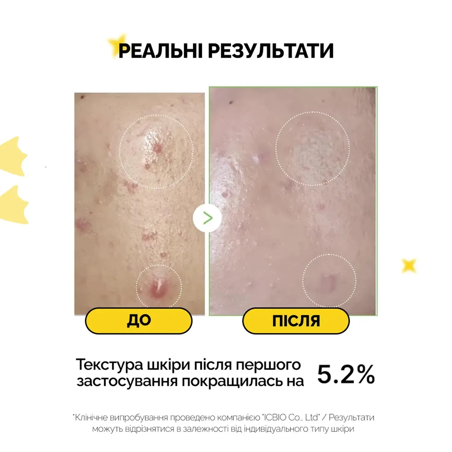 Medicube Успокаивающая сыворотка с экзосомами центели и чайным деревом Exosome Cica Ampoule 30 мл - фото 2