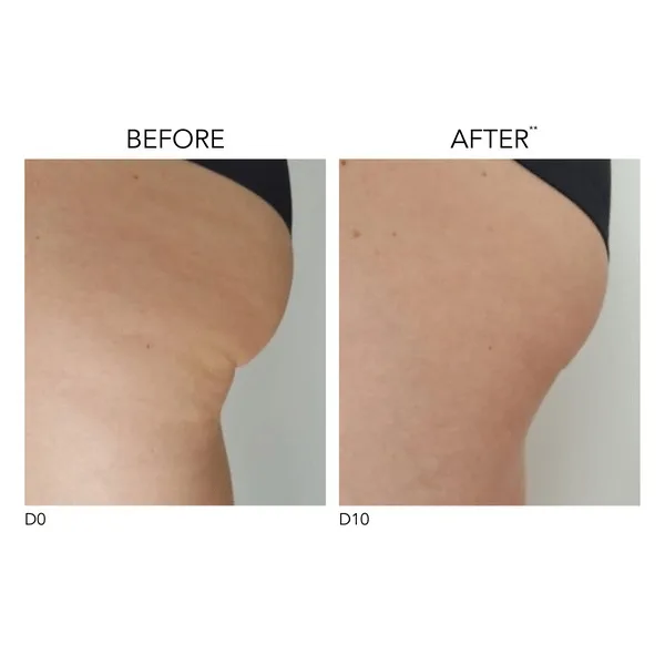 ENEOMEY Укрепляющее молочко для тела с гликолевой кислотой 30% PERFECT BODY 30 - фото 2