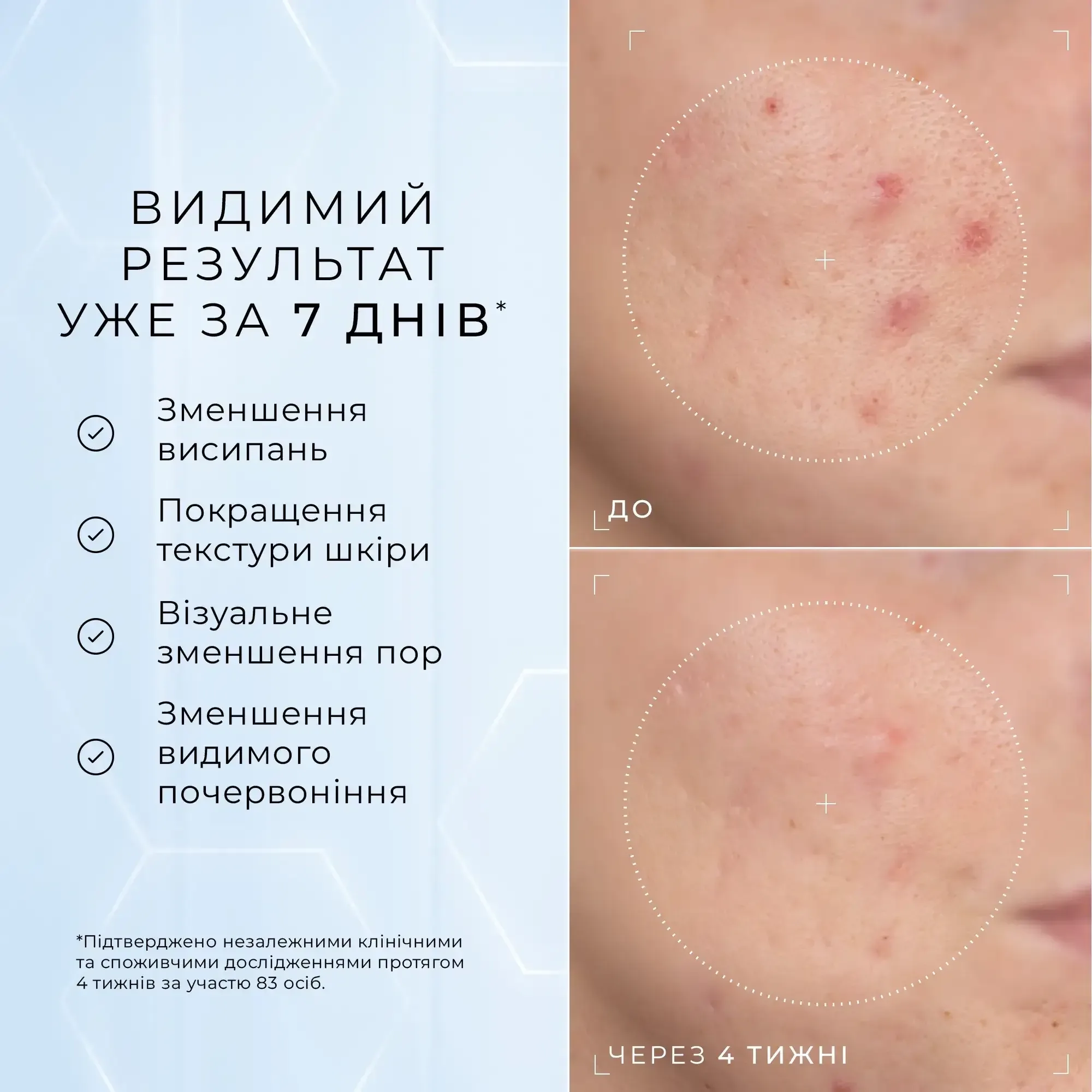 Medik8 Сыворотка с ниацинамидом, пептидами и ацетилглюкозамином Niacinamide Peptides 30 мл - фото 2