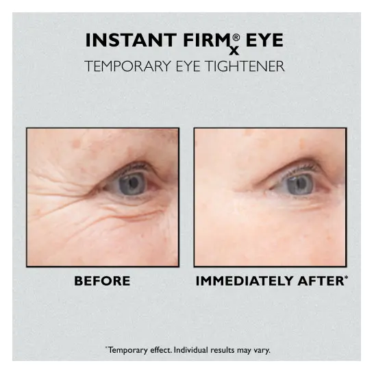 Peter Thomas Roth Крем для разглаживания кожи вокруг глаз Instant FIRMx Eye Temporary Eye Tightener 15 мл - фото 3